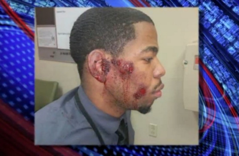 CREDIT: SCREENSHOT/FOX 2 NEWS