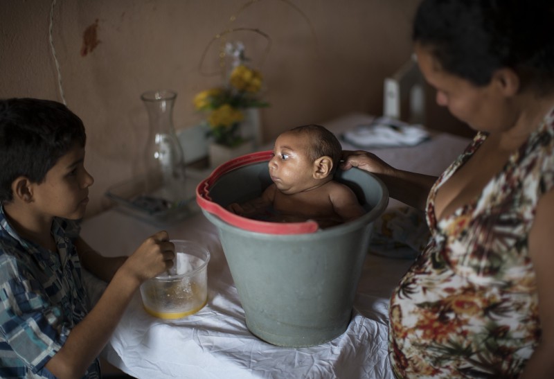 In this Dec. 23, 2015 photo, 10-year-old Elison, left, watches as his mother Solange Ferreira bathes Jose Wesley in a bucket at their house in Poco Fundo, Pernambuco state, Brazil. Ferreira says Jose Wesley enjoys being in the water, she places him in the bucket several times a day to calm him. CREDIT: AP PHOTO/FELIPE DANA