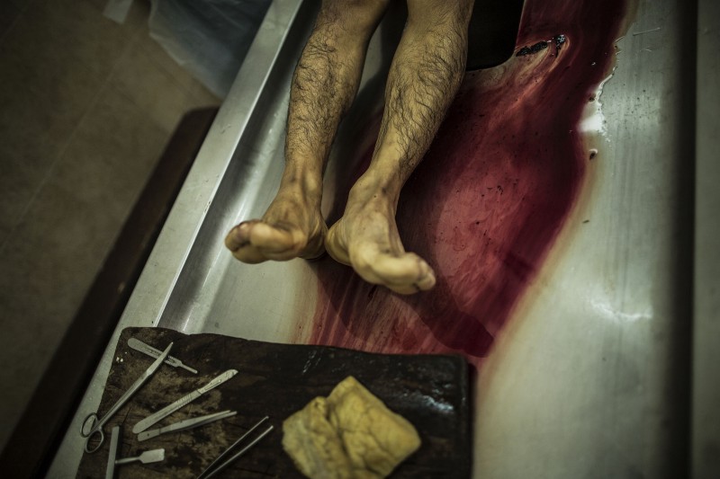 This May 27, 2015 photo shows the body of a 16-year-old Mara Salvatrucha gang member, on a morgue table at the Institute of Legal Medicine, in San Salvador, El Salvador. CREDIT: AP Photo/Manu Brabo