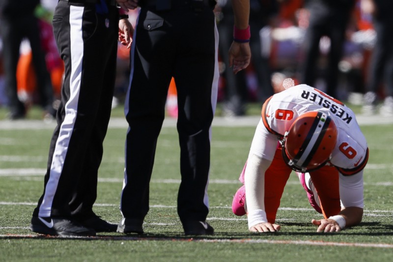 All but one NFL player’s brain examined was diagnosed with CTE. Credit: AP Photo