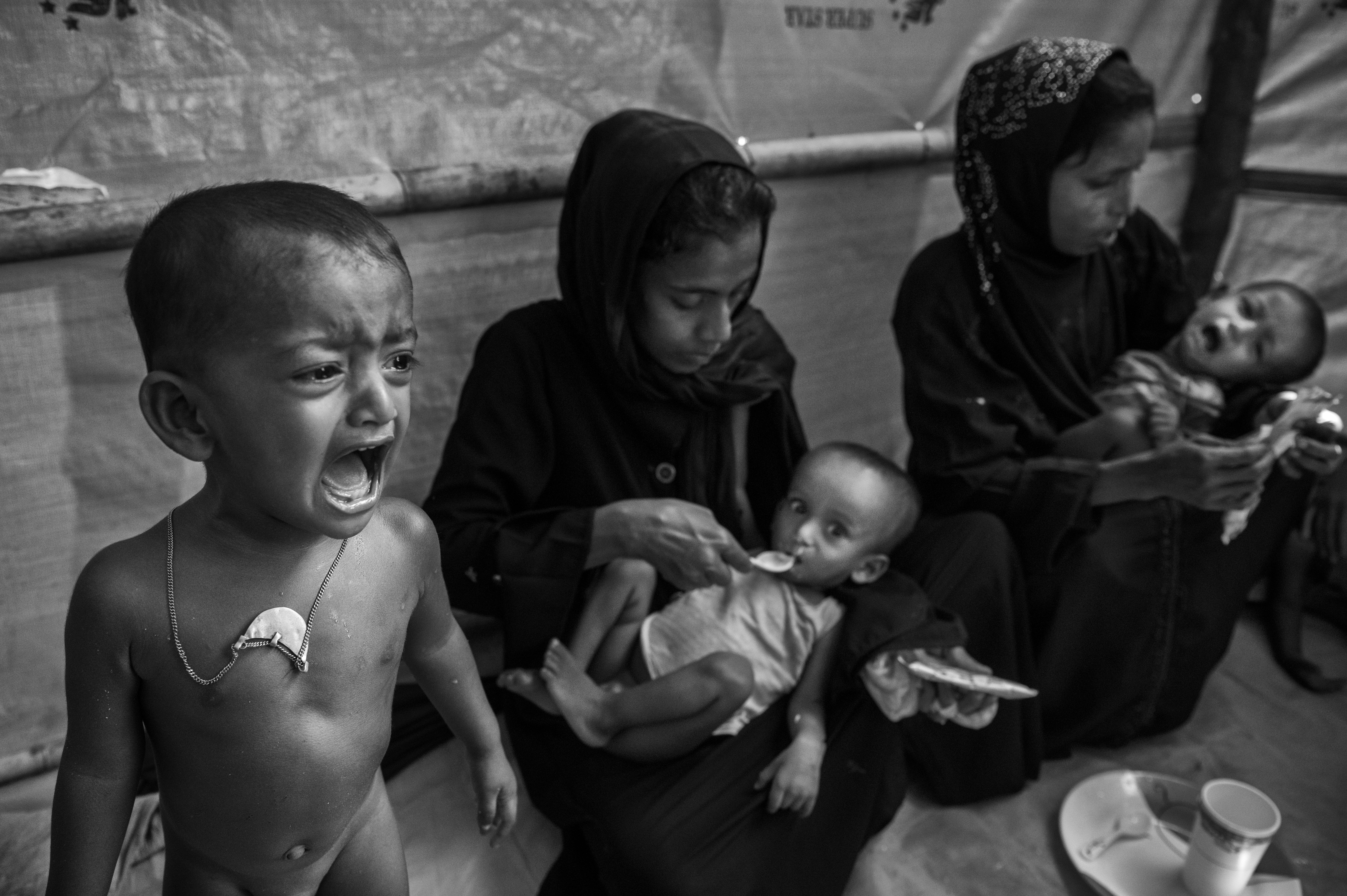 A malnourished Rohingya Muslim refugee boy cries as mothers feed high calorie peanut paste to their malnourished children at a field clinic. (CREDIT: Kevin Frayer/Getty Images)