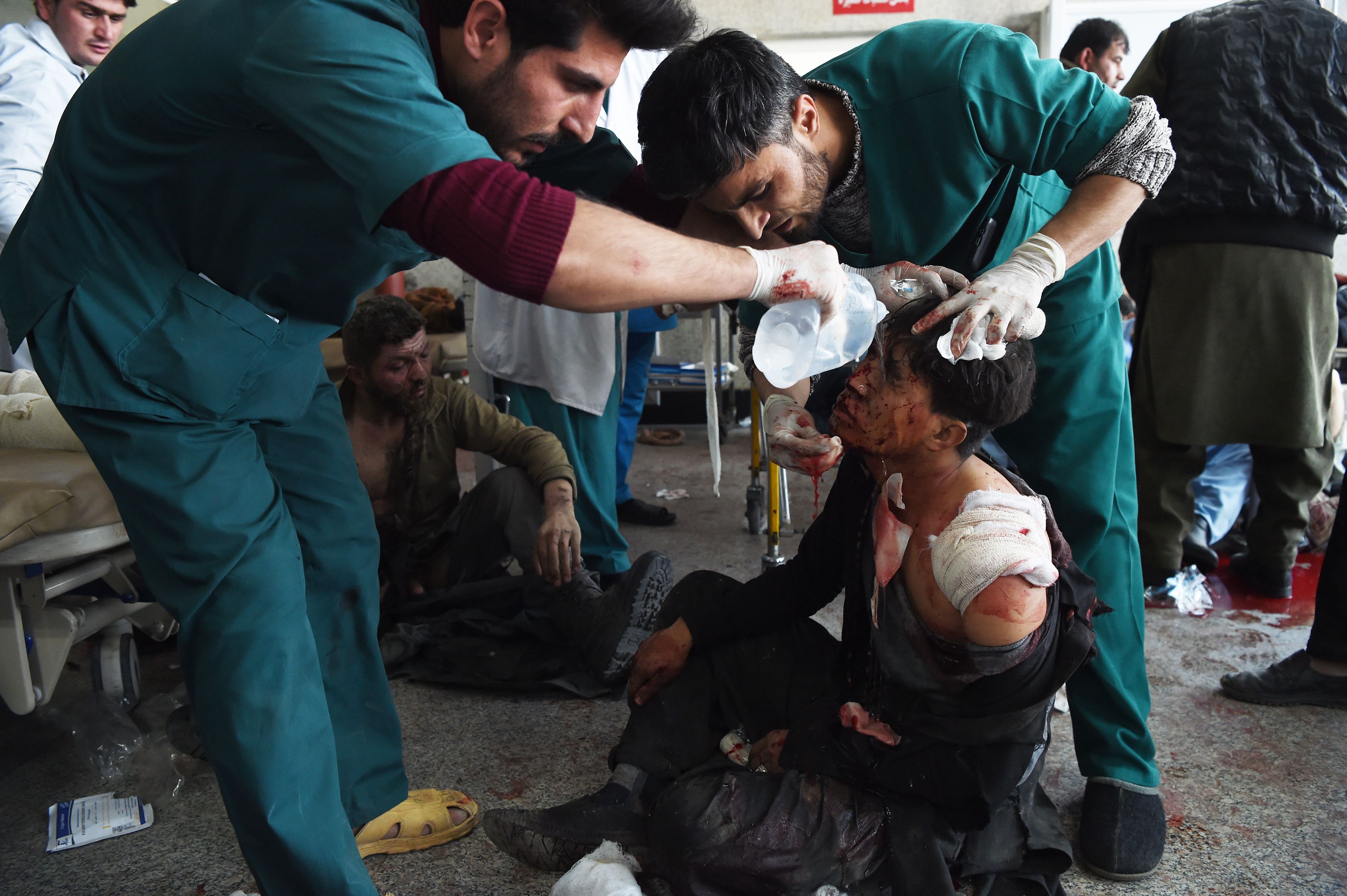 Afghan medical staff treat a wounded man after a car bomb exploded near the old Interior Ministry building, at Jamhuriat Hospital in Kabul on January 27, 2018. CREDIT: Wakil Kohsar/AFP/Getty Images.