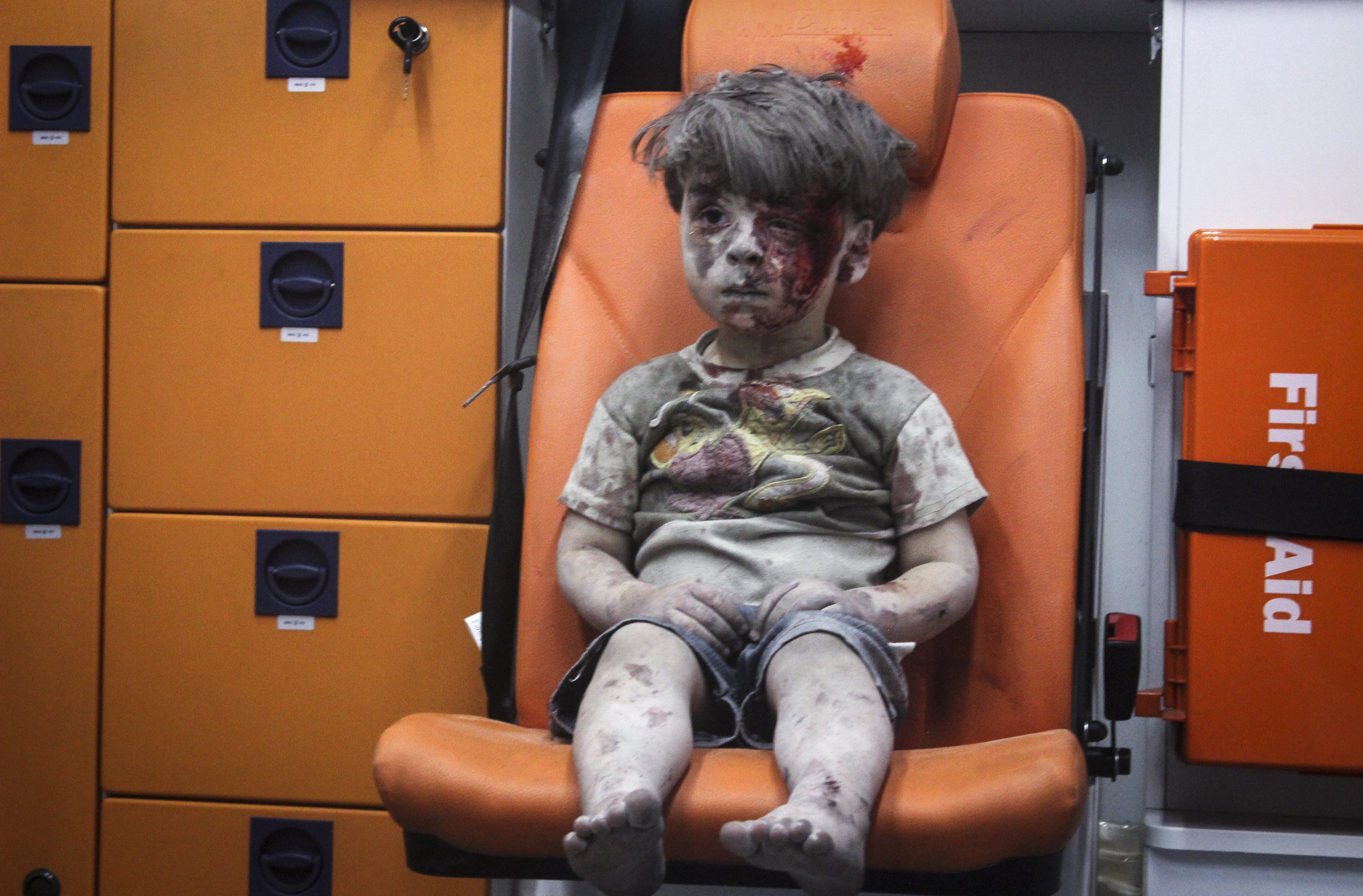 5-year-old wounded Syrian kid Omran Daqneesh sits alone in the back of the ambulance after he got injured on August 17, 2016. CREDIT: Mahmud Rslan/Anadolu Agency/Getty Images