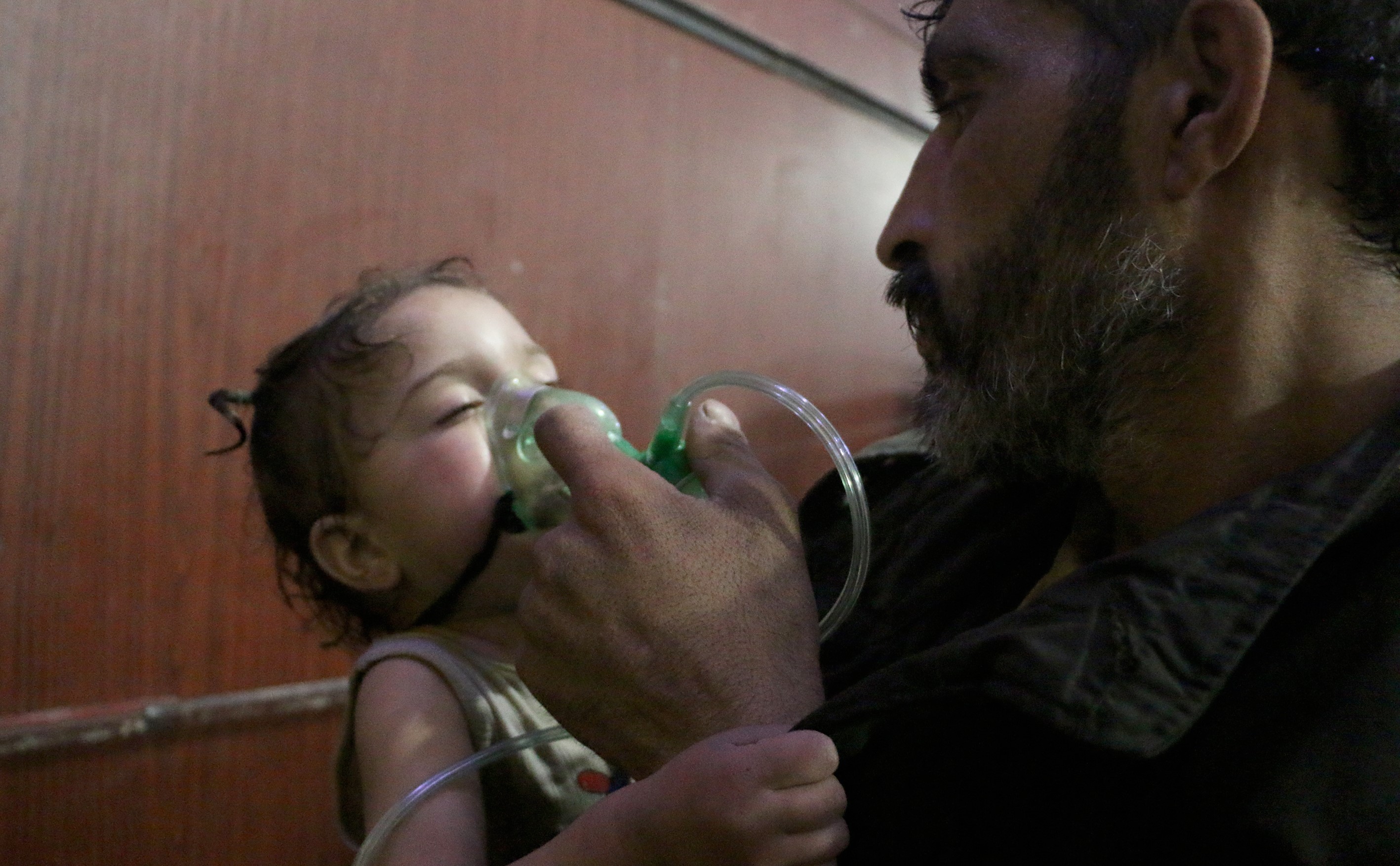 A Syrian baby receives medical treatment after Assad regime forces allegedly conducted poisonous gas attack to Duma town of Eastern Ghouta in Damascus, on Sunday. At least 78 civilians died, including women and children, according to the initial findings. (CREDIT: Mouneb Taim/Anadolu Agency/Getty Images)
