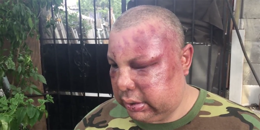 Jorge Alberto “George” Gomez, who was beaten at a bar by two off-duty policy officers, in New Orleans, Louisiana. (PHOTO CREDIT: screenshot, WDSU via The Advocate)
