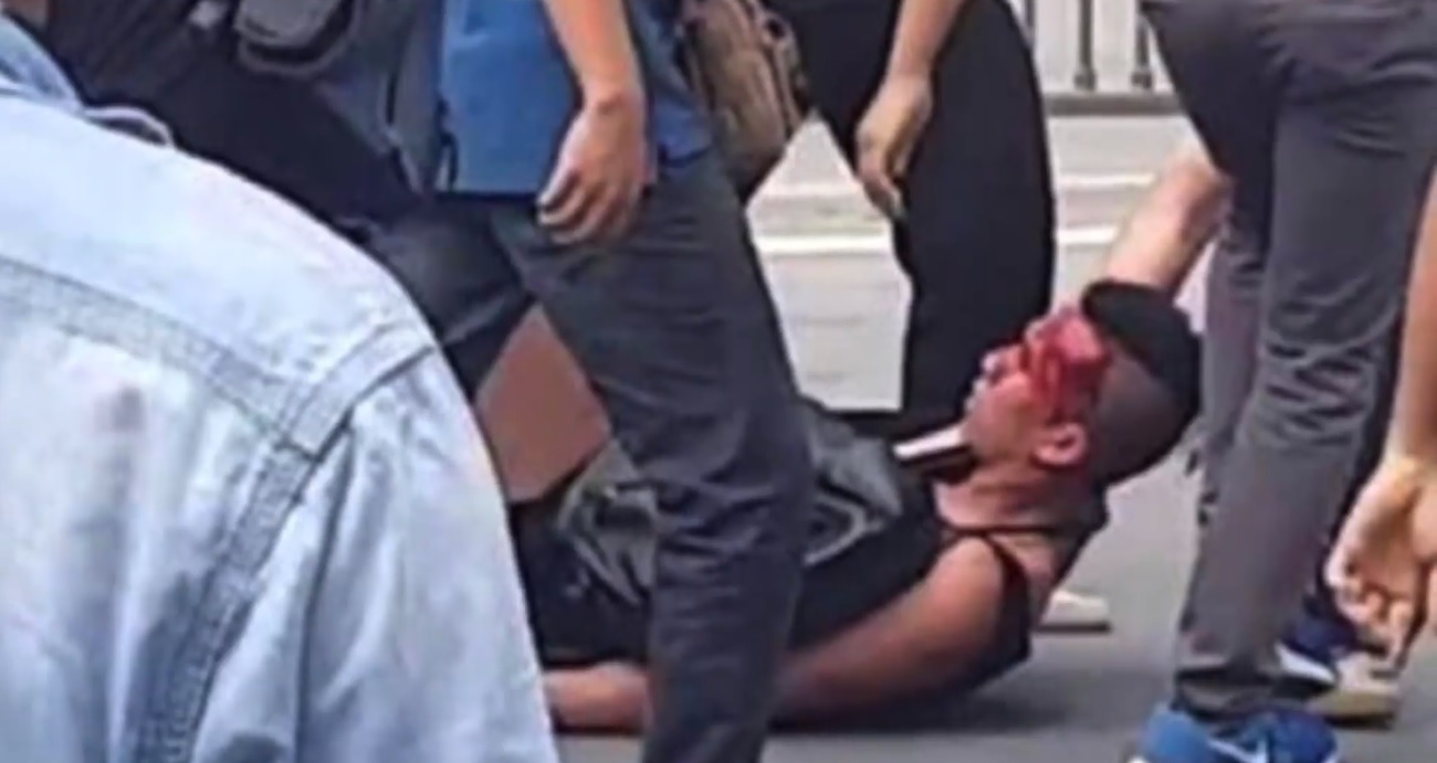 William Nguyen was beaten during the protests on June 10. (Credit: Screenshot, Facebook, Free Will Nguyen)