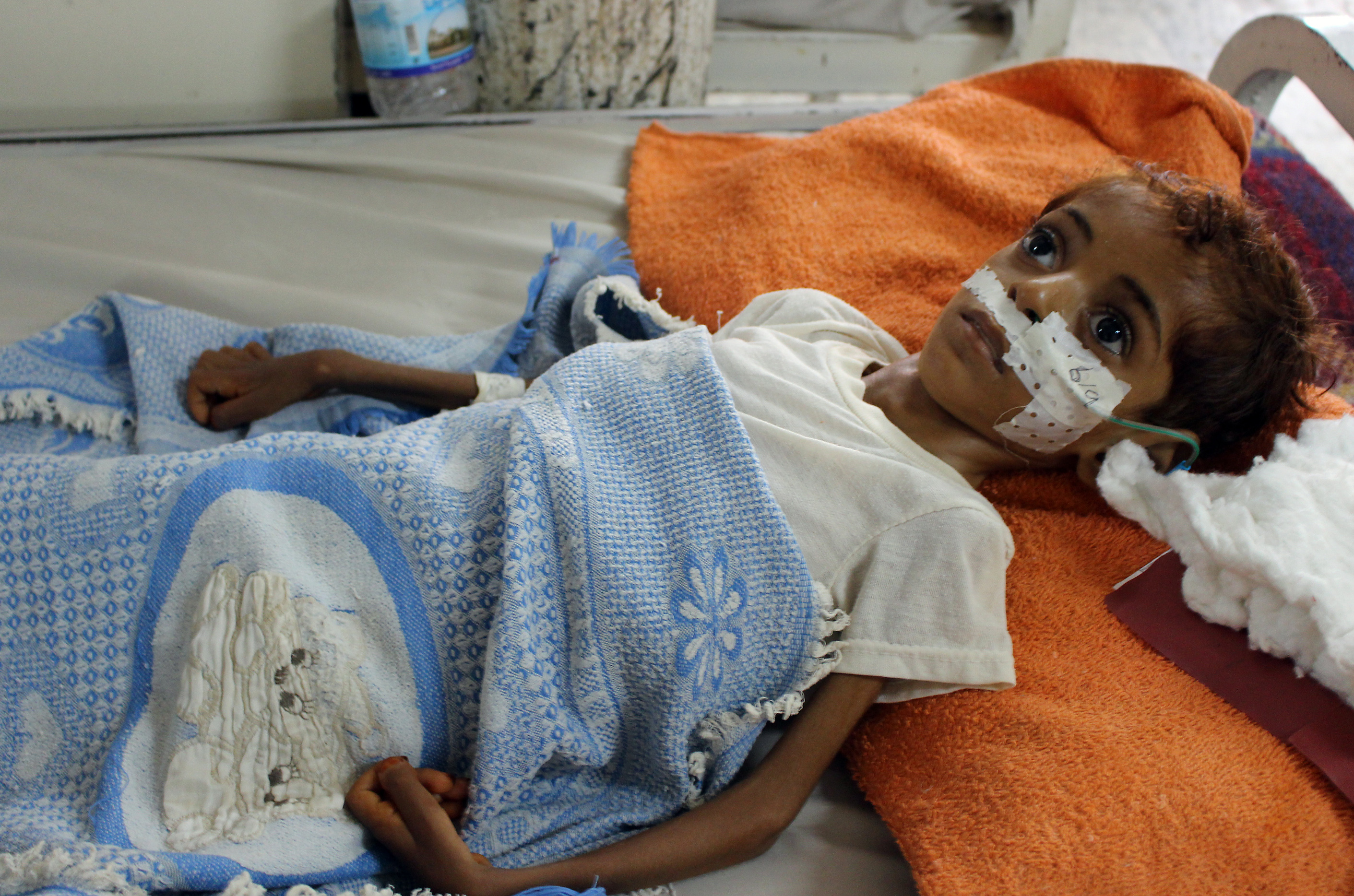 A Yemeni child suffering from malnutrition receives treatment at a hospital in the northern district of Abs, in Yemen's Hajjah province on September 8, 2018. The war has pushed Yemen, the Arab world's poorest country, to the brink of famine. CREDIT: Essa Ahmed/AFP/Getty Images.