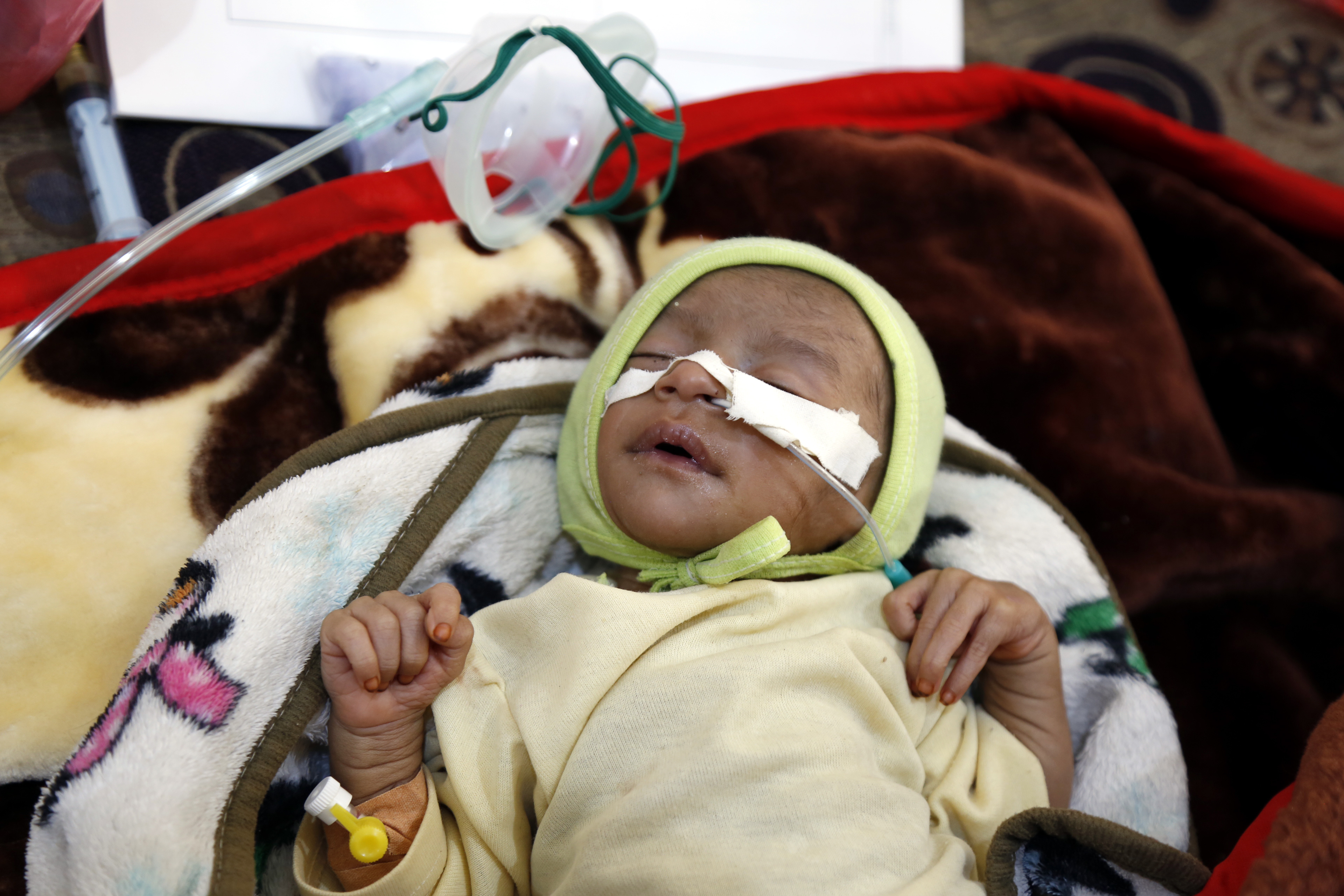 A baby receives treatment from nurses at a hospital on December 06, 2018 in Sana'a, Yemen. CREDIT: Mohammed Hamoud/Getty Images.